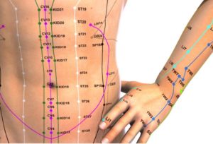 body acupuncture